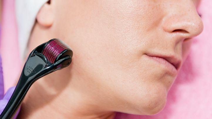 Derma Roller for Anti Ageing Scar Removal and Hair Regrowth